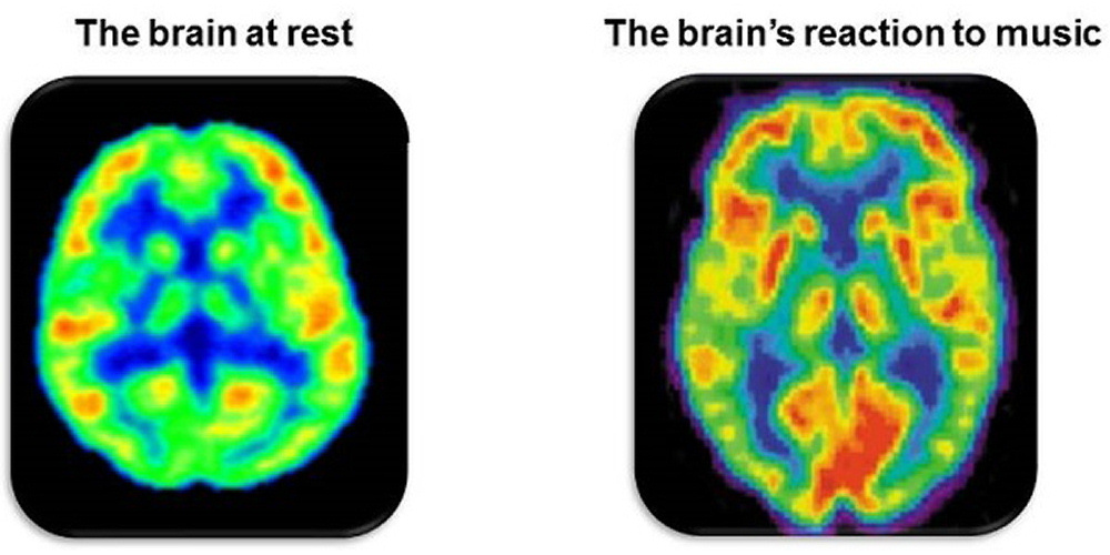 Musik er motion for hele hjernen