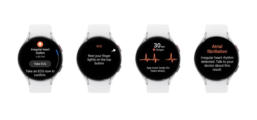 Galaxy Watch vil kunne advare dig om hjerteproblemer