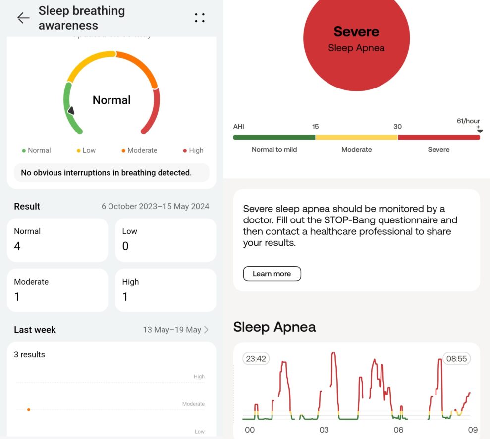 Huawei Watch Fit 3 5 sleep apnea