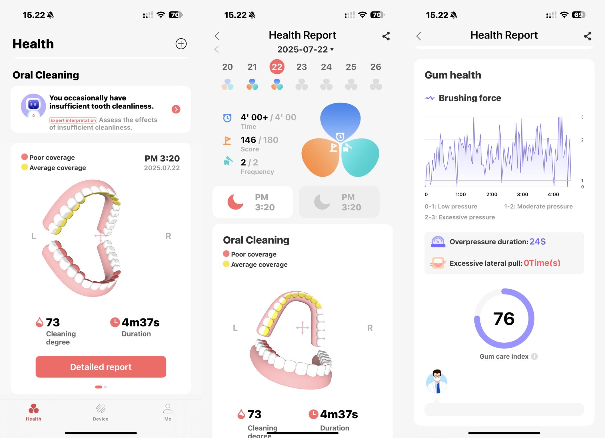 Oclean App screenshots
